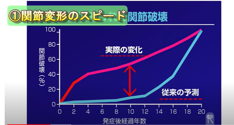 関節リウマチの治療ってどうするの？